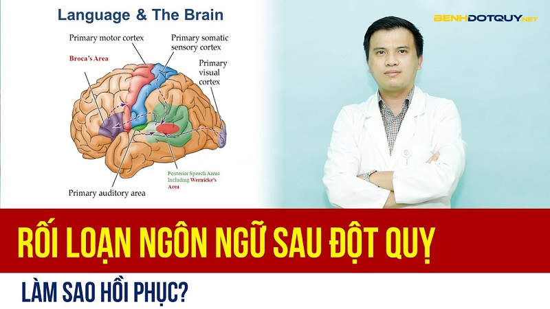 Rối loạn ngôn ngữ sau đột quỵ, làm sao hồi phục?