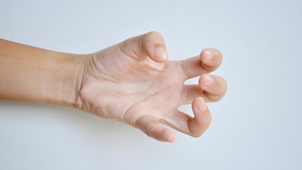 Co cứng sau đột quỵ ảnh hưởng đến bệnh nhân ra sao?