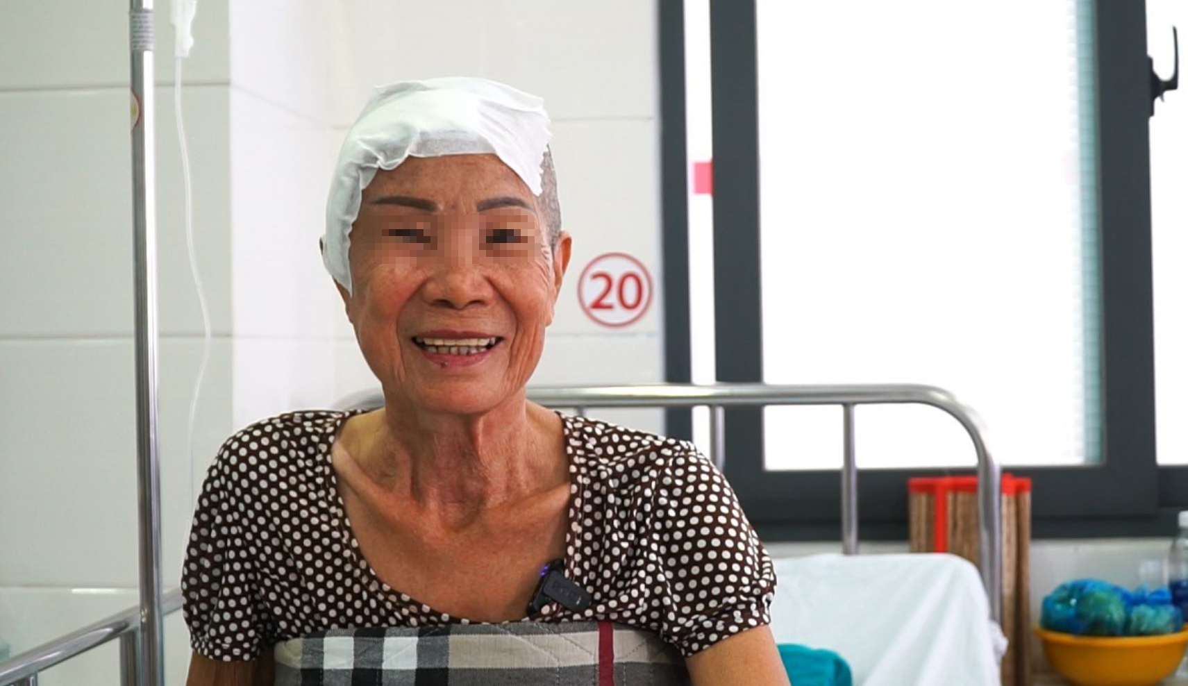 Cứu sống ngoạn mục nữ bệnh nhân vỡ mạch máu não khi cố hát karaoke