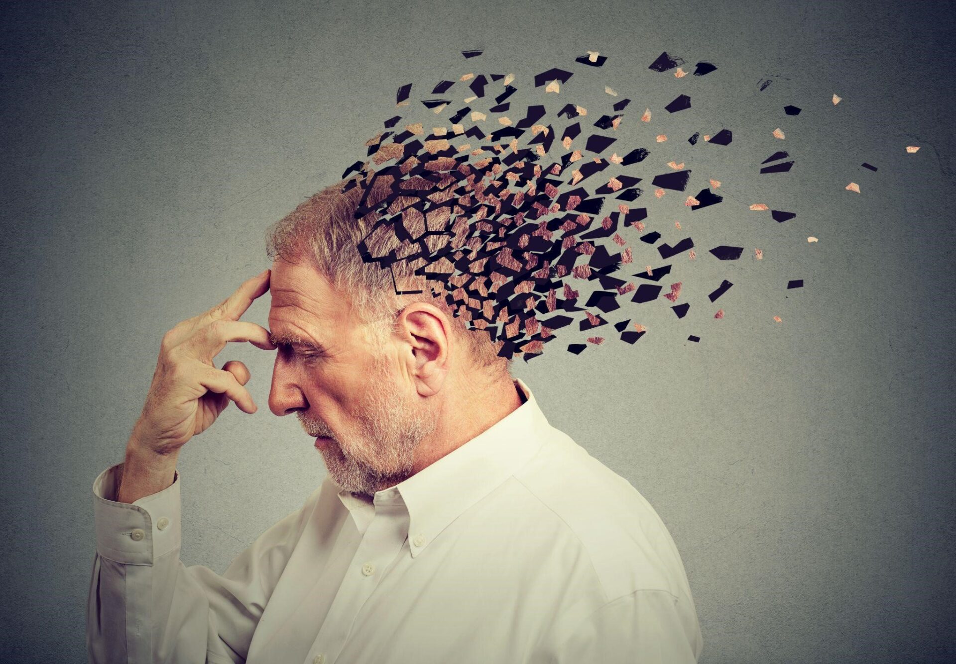 Alzheimer là một bệnh rối loạn thần kinh tiến triển làm cho não thu nhỏ và các tế bào não chết đi.