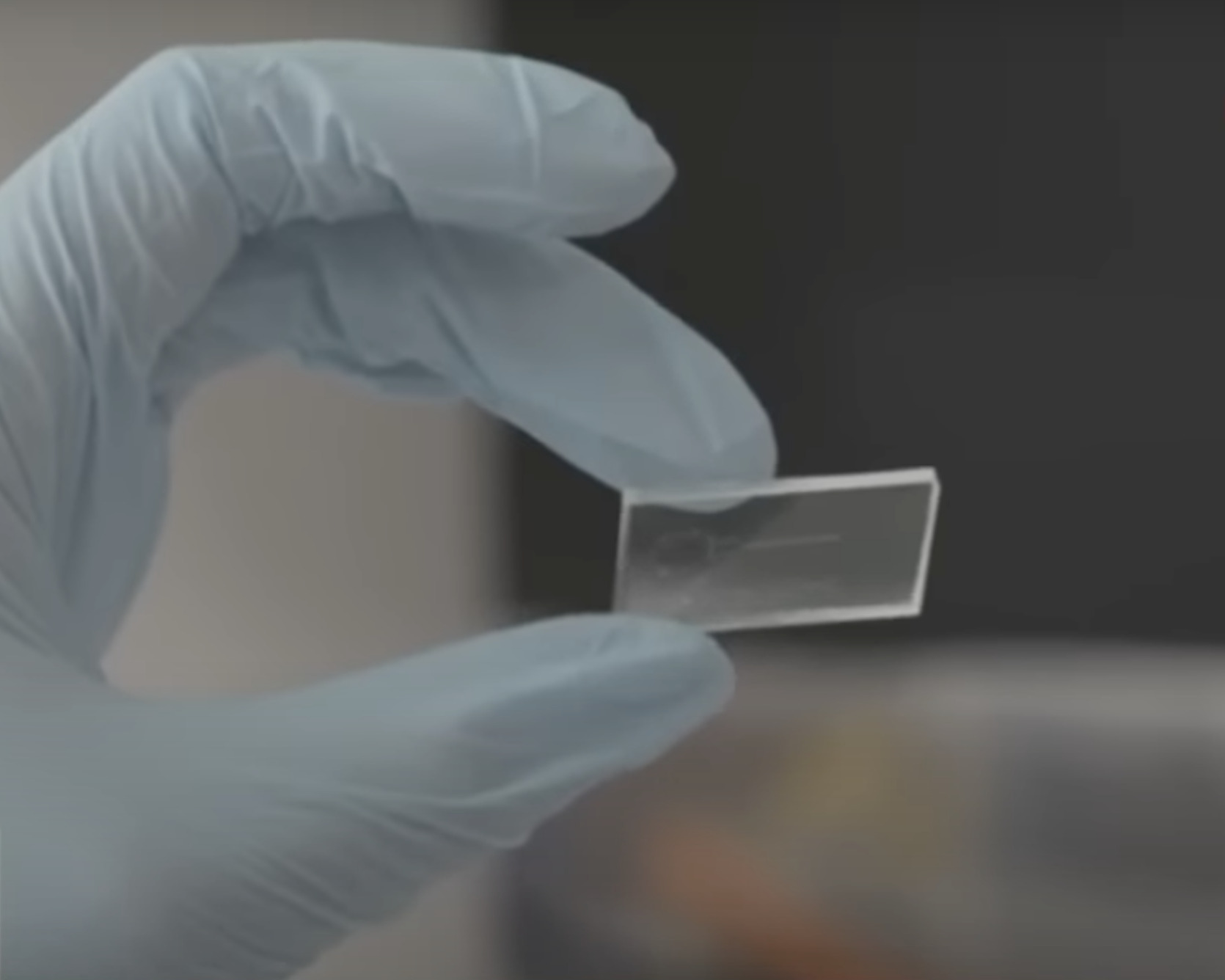 Các nhà nghiên cứu tại Úc đã sáng chế ra con chip có khả năng cảnh báo nguy cơ đột quỵ, đau tim.