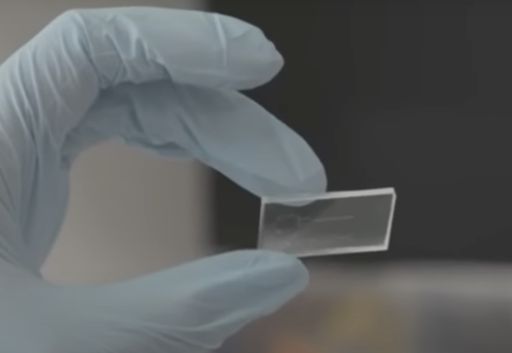 Nghiên cứu mới: Con chip cảnh báo nguy cơ đột quỵ, đau tim