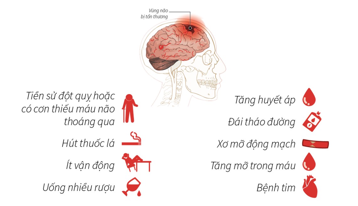 yếu tố nguy cơ đột quỵ