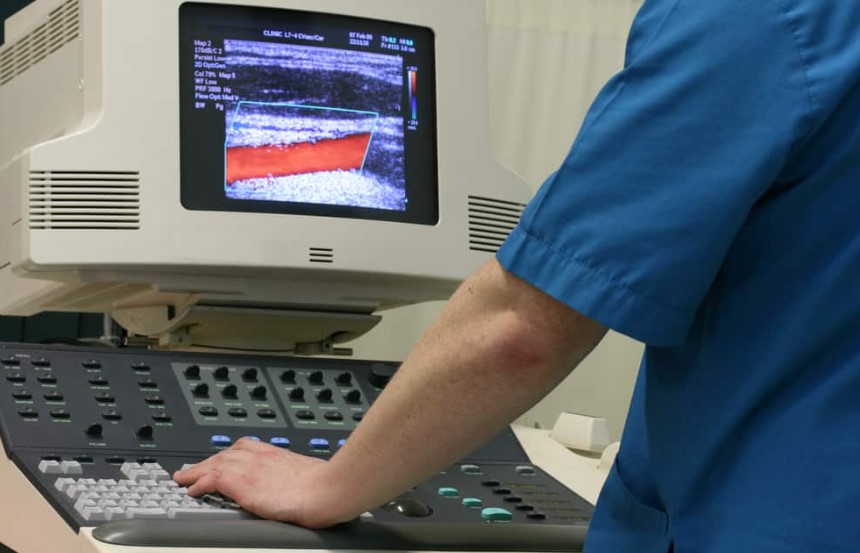 Quy trình và thời gian thực hiện siêu âm doppler động mạch cảnh?