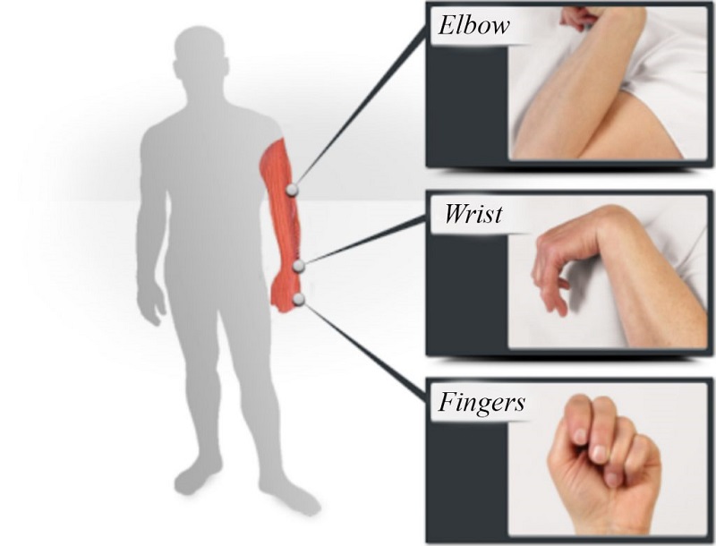 Nguyên nhân và thời điểm bị co cứng cơ sau đột quỵ?