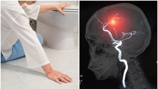 Thời gian nhận tPA ở người đột quỵ do thiếu máu cục bộ?