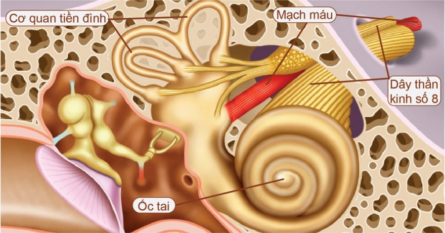 U dây thần kinh thính giác: Dấu hiệu nhận biết và cách điều trị