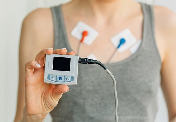 Holter điện tâm đồ sẽ giúp ghi lại các tín hiệu điện của trái tim liên tục trong thời gian từ 24-48 giờ.