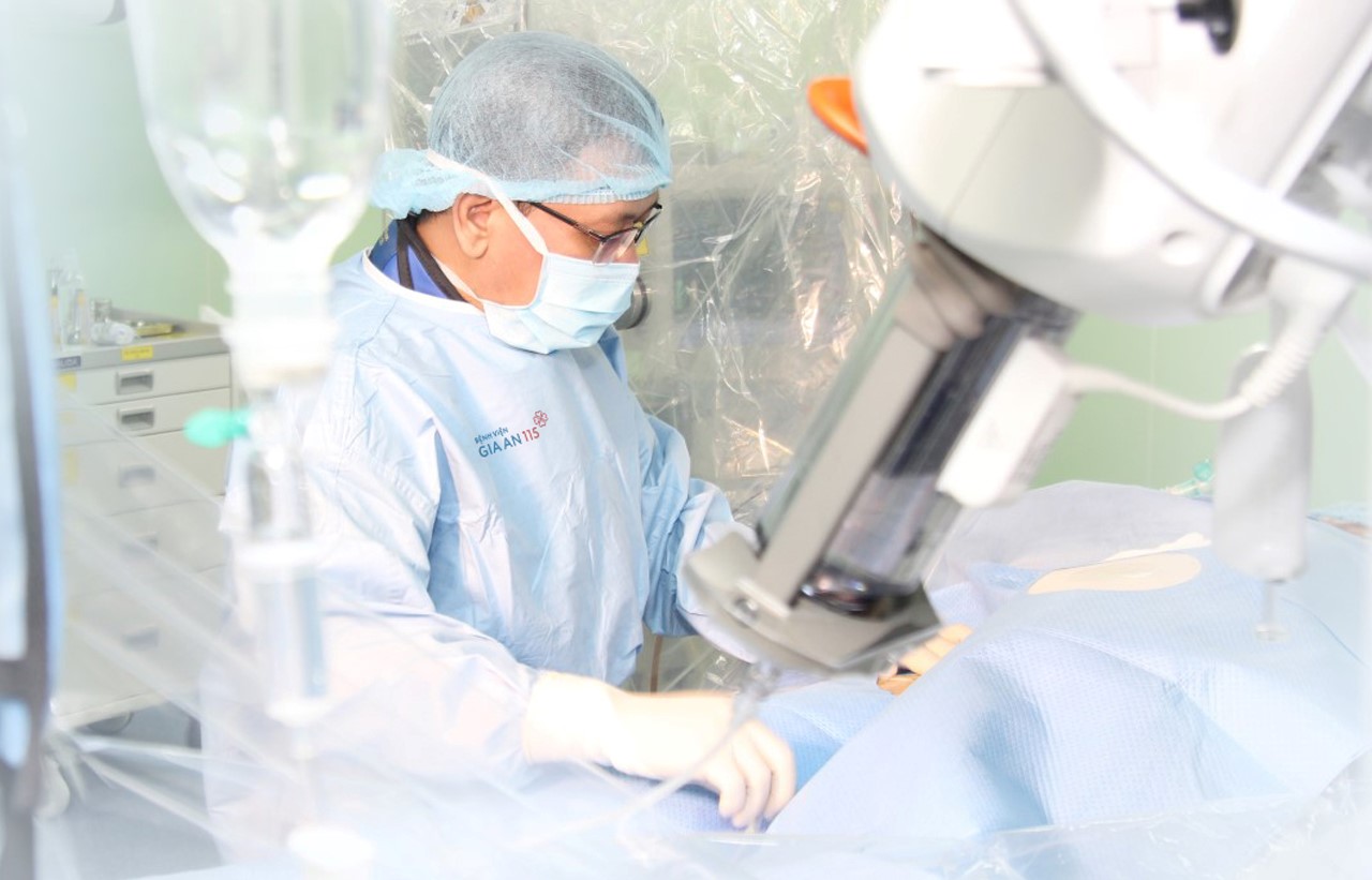 Bệnh nhân đột quỵ khi nào cần can thiệp DSA?