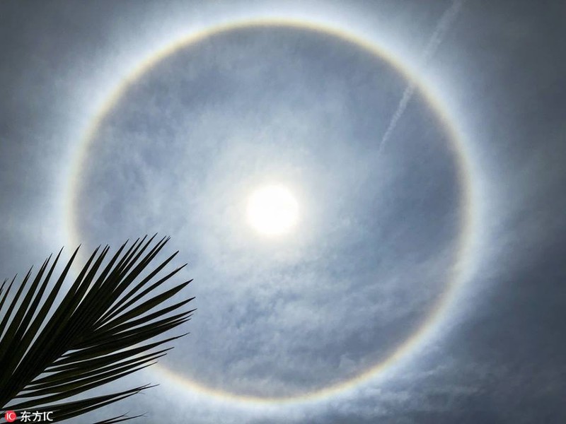 Khi bị đột quỵ thị lực giảm đột ngột, còn đau nửa đầu sẽ thấy hào quang.