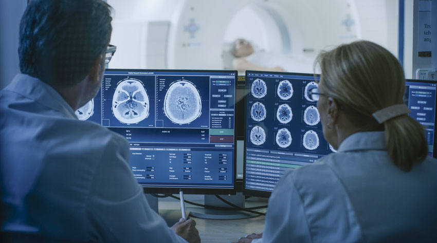 Bệnh mạch máu não: Nguyên nhân, điều trị và cách phòng ngừa