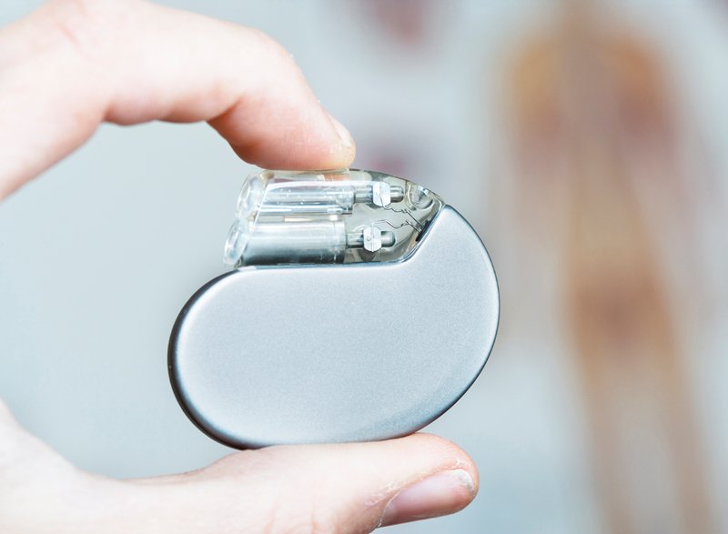 Máy tạo nhịp tim được đặt trong những trường hợp nào?