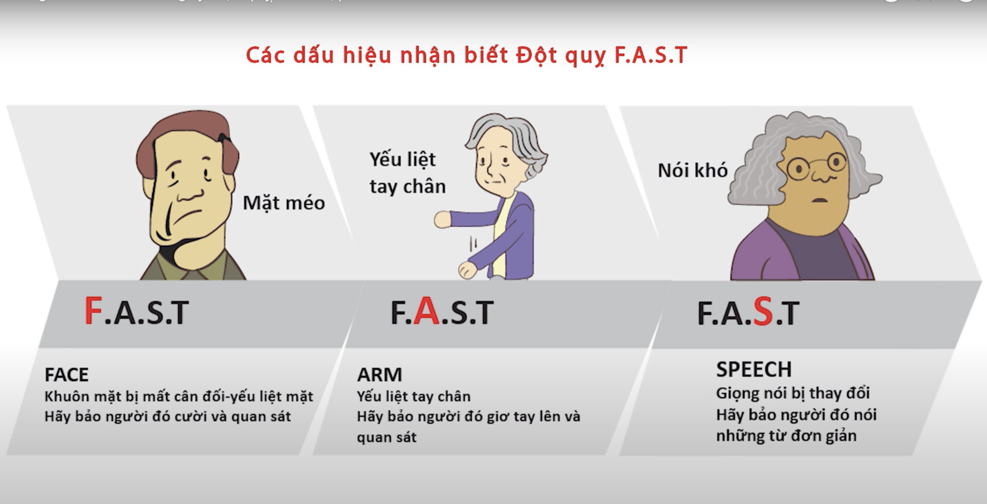 Các dấu hiệu nhận biết đột quỵ.