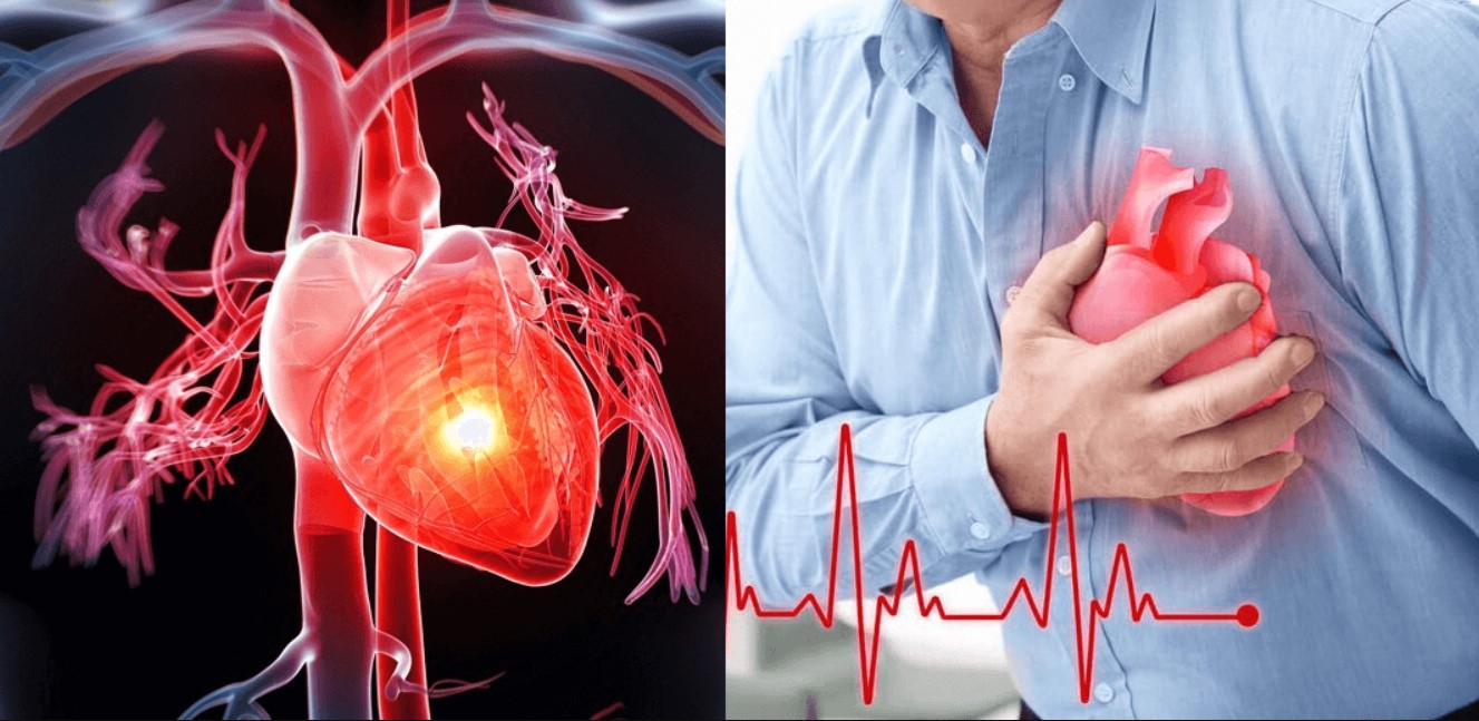 Đau tức giữa ngực với nguyên nhân do tim là bệnh lý thường gặp và đáng lo ngại nhất.