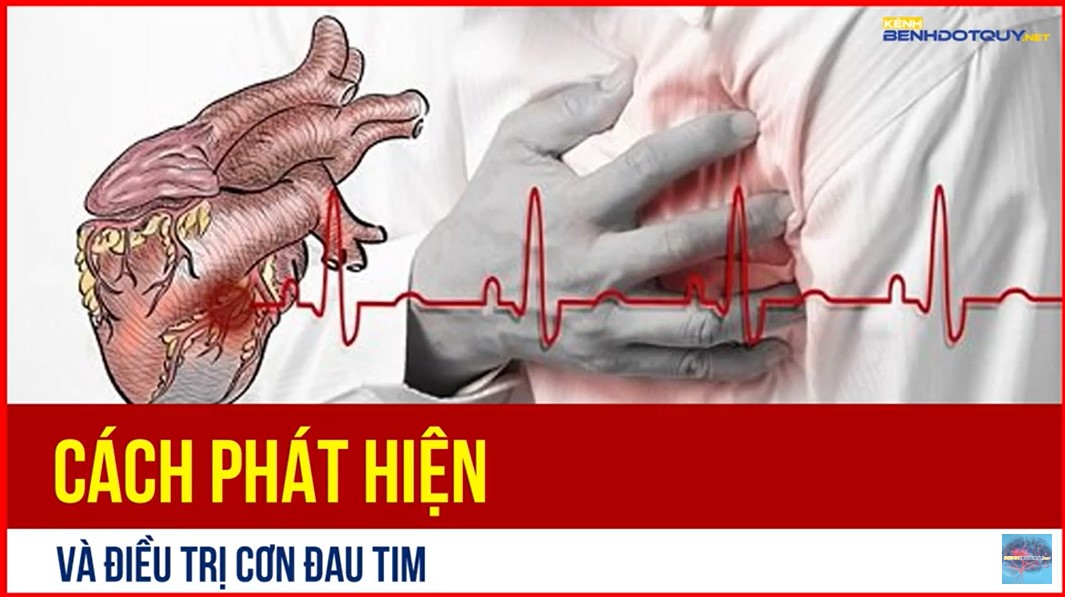 Cách phát hiện và điều trị cơn đau tim