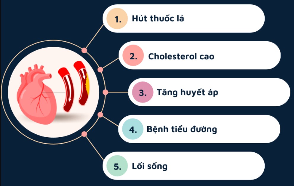 Vì sao bệnh động mạch vành ngày càng trẻ hoá?