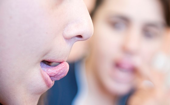 Luyện nói bằng cách thực hiện các cử động lưỡi thường xuyên.