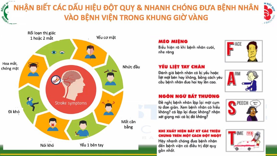 Nhận biết các dấu hiệu đột quỵ và nhanh chóng đưa bệnh hân vào bệnh viện trong khung giờ vàng.