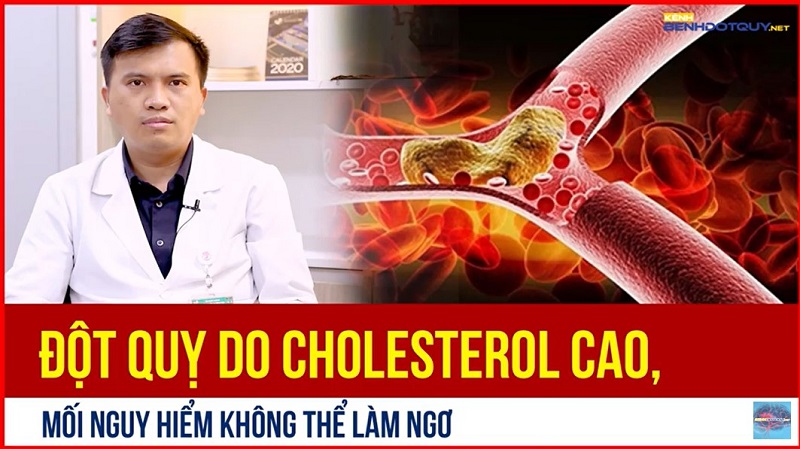 Đột quỵ do Cholesterol cao, mối nguy hiểm không thể làm ngơ