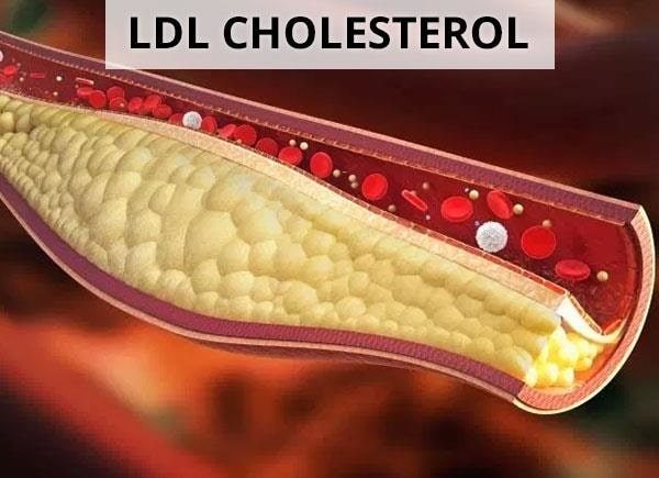 Cholesterol là một chất béo steroid, mềm, màu vàng nhạt, có ở màng tế bào của tất cả các mô trong cơ thể.