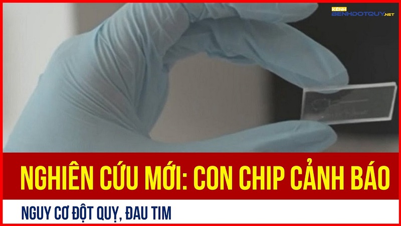 Nghiên cứu mới: Con chip cảnh báo nguy cơ đột quỵ, đau tim?