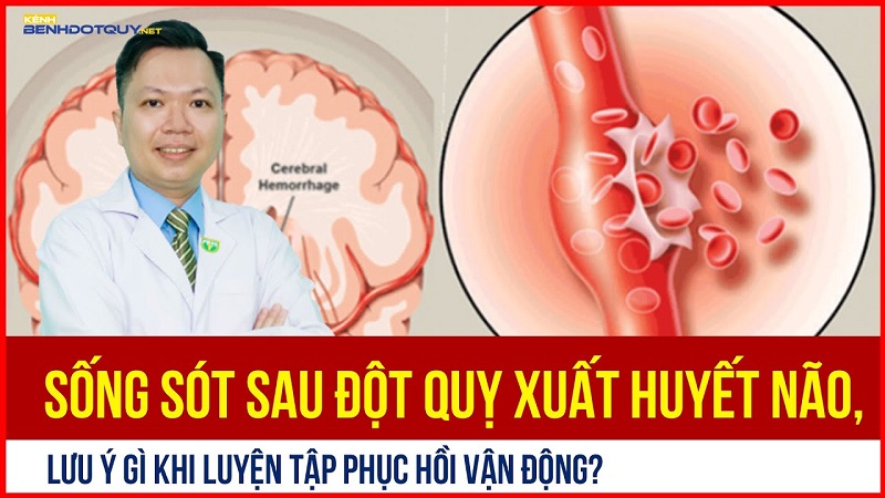 Sống sót sau đột quỵ xuất huyết não, lưu ý gì khi luyện tập phục hồi vận động?