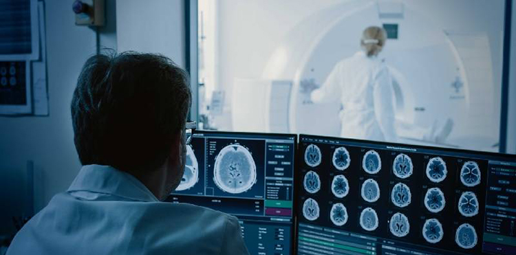 Chụp CT và MRI mạch não là kỹ thuật hình ảnh tiên tiến, được áp dụng rộng rãi trong chẩn đoán các bệnh lý về thần kinh.