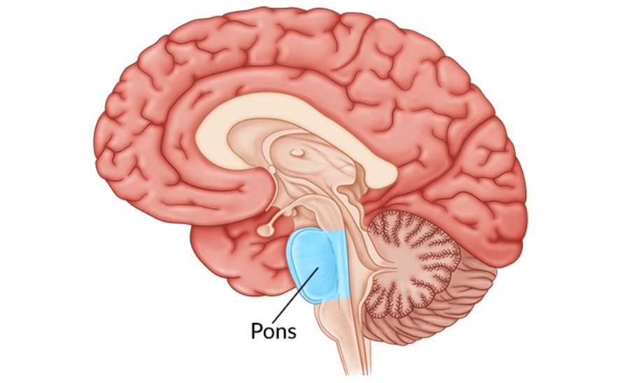 Đột quỵ Pontine: Dấu hiệu, điều trị và cách phục hồi