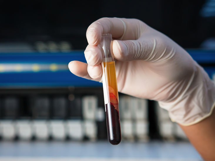 Xét nghiệm thời gian prothrombin (PT) đo mức độ và thời gian máu đông lại.