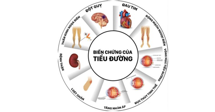 Những biến chứng của bệnh đái tháo đường?