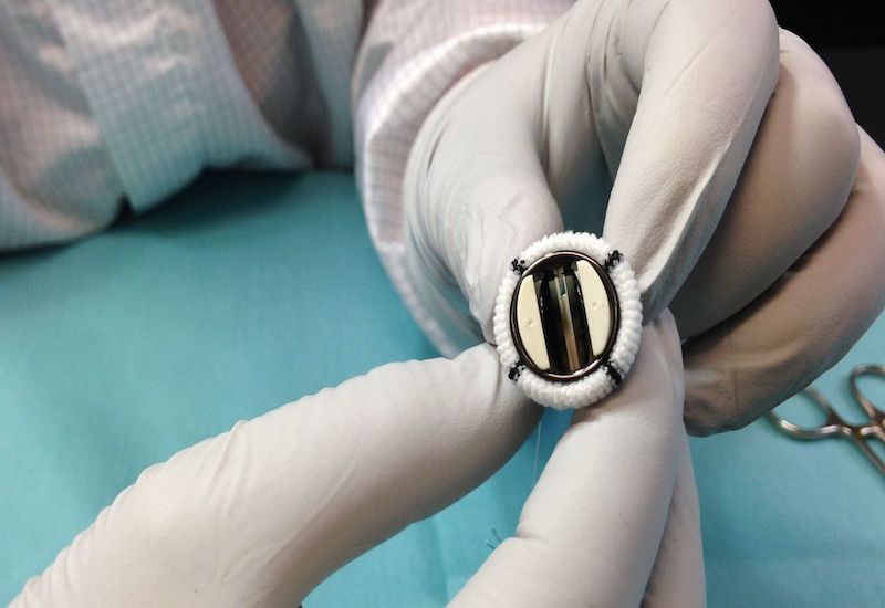 Nếu bệnh nhân dùng thuốc nhưng không hiệu quả, cần phải được tiến hành nong van, sửa van hoặc thay van tim, tránh biến chứng suy tim có thể xảy ra.