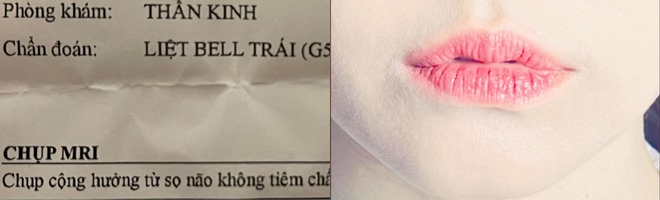 Bà xã Trấn Thành đăng tải hình ảnh, tiết lộ bị bệnh