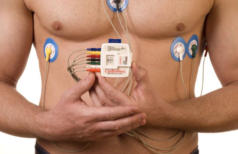 Holter điện tâm đồ là phương pháp ghi điện tâm đồ liên tục trong khoảng thời gian nhất định