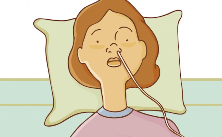 Bệnh nhân đột quỵ có tiền sử tiểu đường cần đặt ống sonde, chăm sóc thế nào?