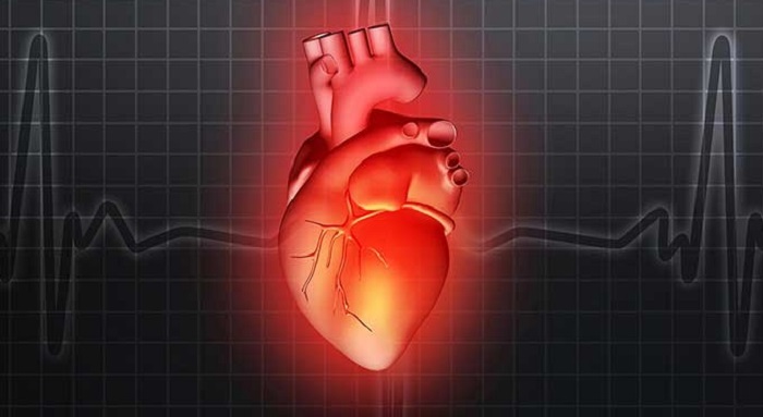 Bệnh có thể gây ra tình trạng rối loạn nhịp tim, rung tâm nhĩ và suy tim.