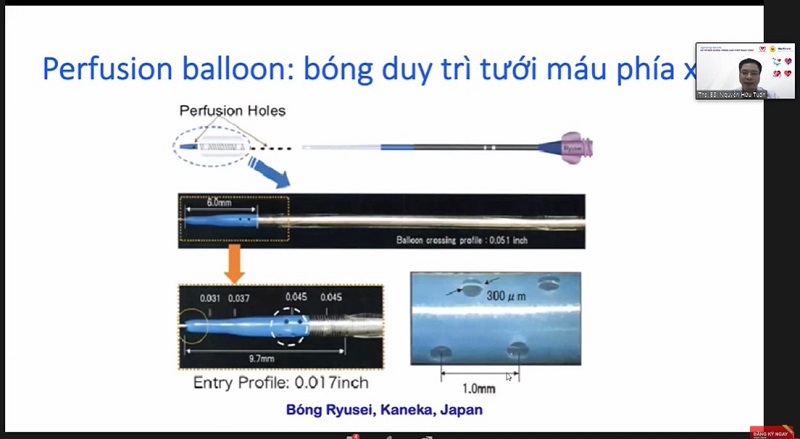 Bóng Perfusion balloon rất hiệu quả để điều trị tổn thương nhưng lại ít được sử dụng
