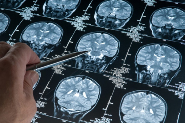 Chụp CT có thể cung cấp cho các bác sĩ nhiều thông tin hơn liên quan đến chấn thương hoặc bệnh của não