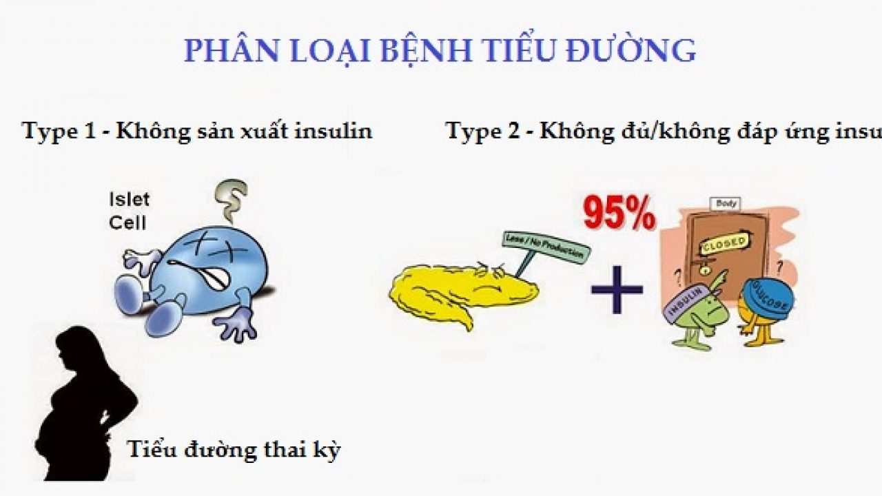 phân loại đái tháo đường