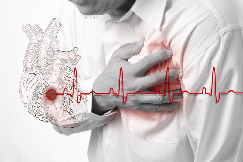 Đau tim là một trong những nguyên nhân tử vong hàng đầu ở nước ta.