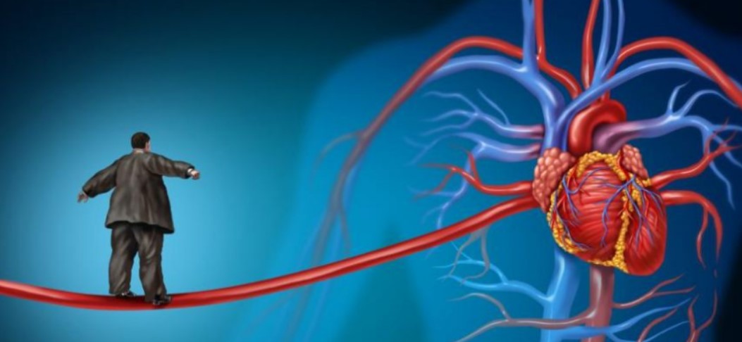 Bị suy tim sung huyết có thể sống được bao lâu?