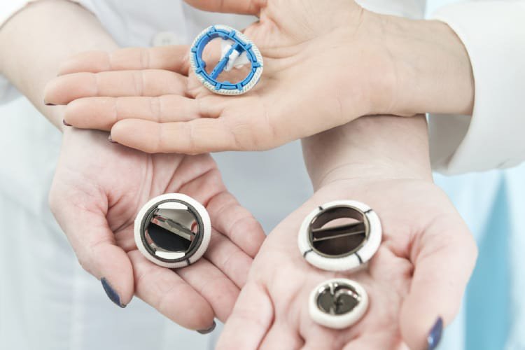 Nếu van tim không thể được sửa chữa và thủ thuật dựa trên ống thông không phải là một lựa chọn, thì van có thể cần được thay thế.