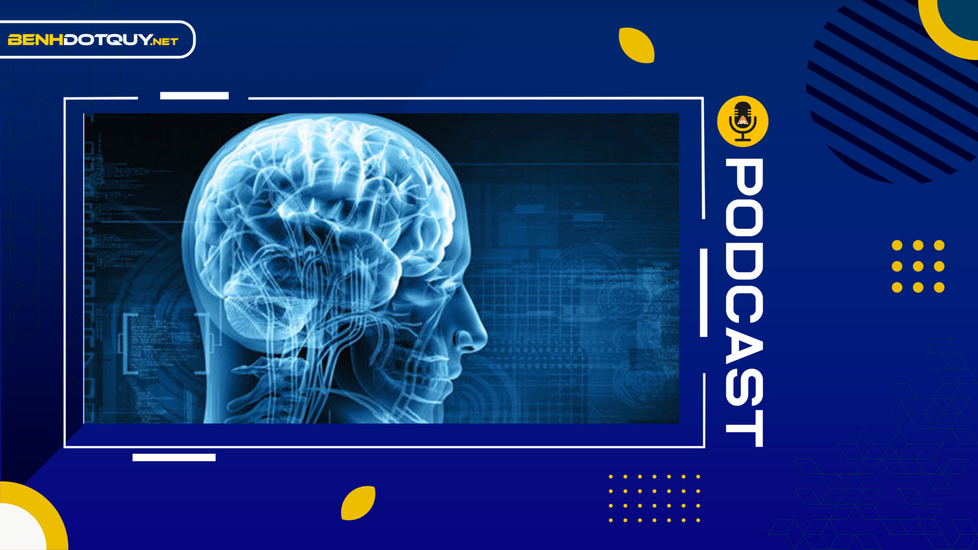 Bạn biết gì về đột quỵ thân não?