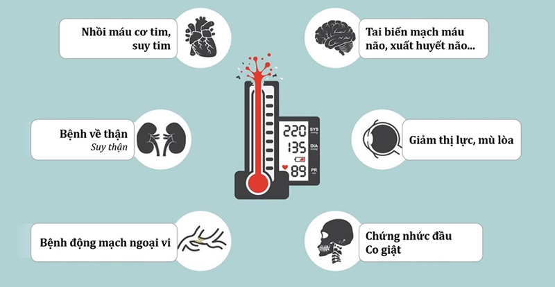 Tăng huyết áp lâu dài gây ra biến chứng nặng nề, có thể dẫn tới tử vong.