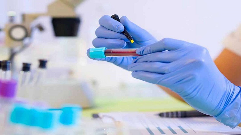 Bác sĩ có thể lấy mẫu máu để tìm lượng hormone tuyến giáp cao.