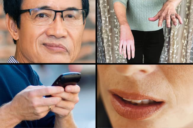 Gọi ngay cấp cứu 115 khi gặp ai đó bị đột quỵ để không trễ giờ vàng điều trị.