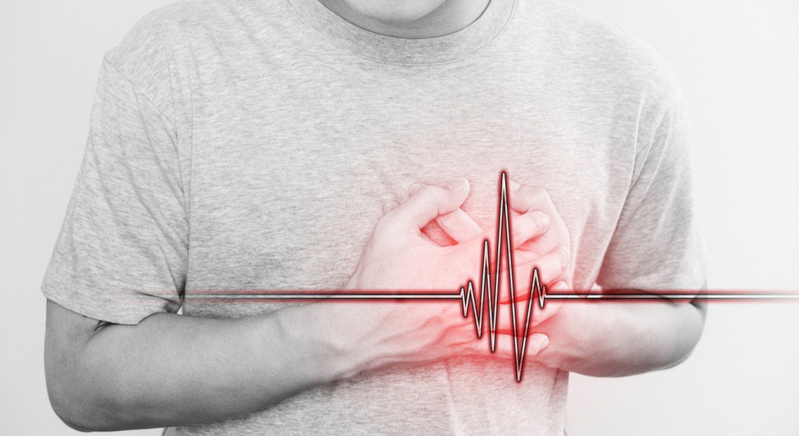 Dấu hiệu nhận biết đột quỵ tim?