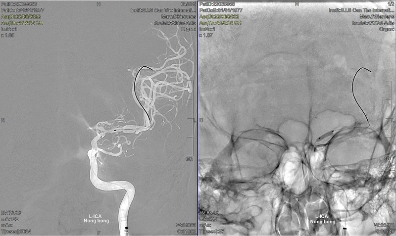 Ở Mỹ không phát hiện, về Việt Nam tìm ra bệnh hiểm