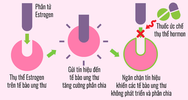 Liệu pháp hormone trong điều trị ung thư vú.