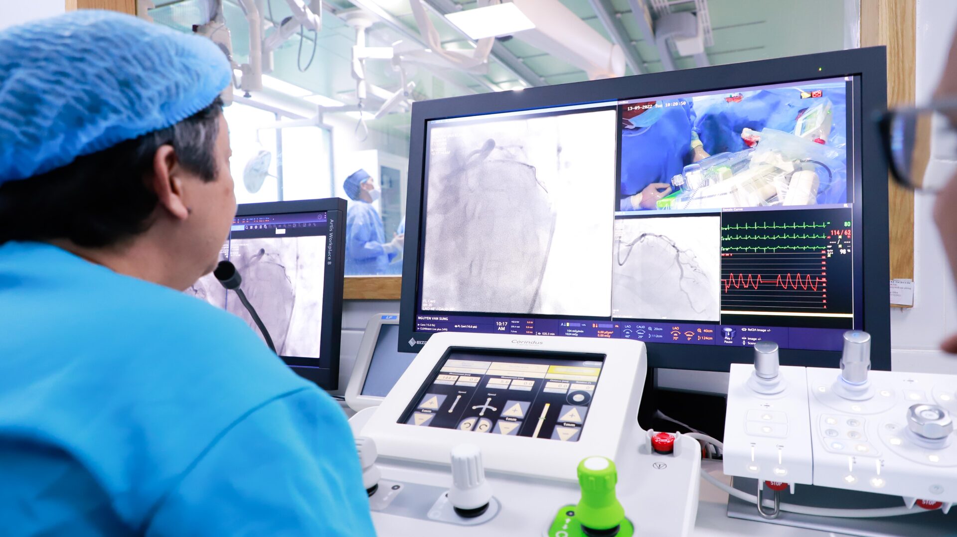 Các chuyên gia nhận định Corindus chính là tương lai của tái thông mạch máu. 