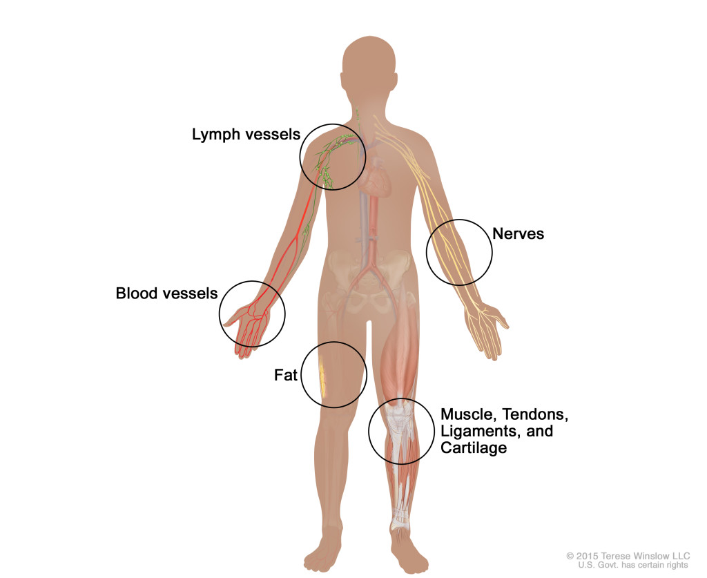Các loại sarcoma.